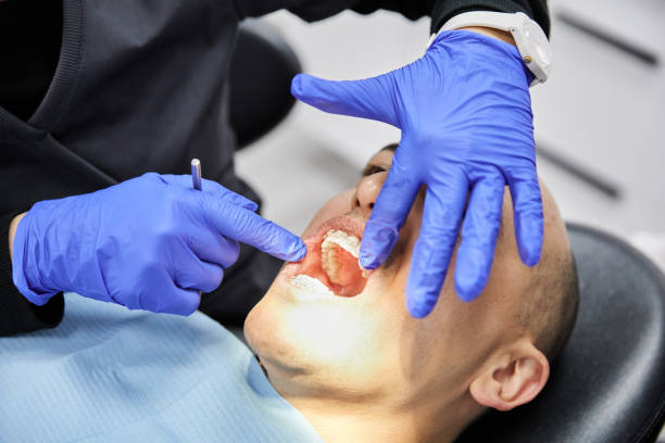 Best Dentist for Tooth Abscess  in Greeley, CO